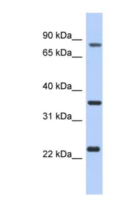 LINC02875 Antibody, Novus Biologicals 100&mu;L; Unlabeled:Antibodies, Polyclonal