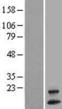 Novus Biologicals™ OXLD1 Overexpression Lysate