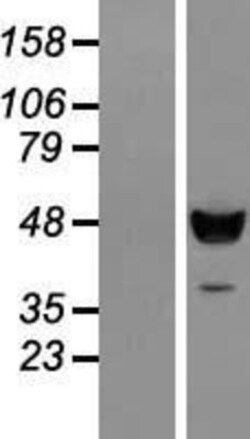 Novus Biologicals™ C18orf25 Overexpression Lysate