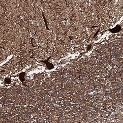 C18orf32 Antibody, Novus Biologicals:Antibodies:Primary Antibodies