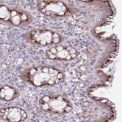 AKAIN1 Antibody, Novus Biologicals:Antibodies:Primary Antibodies