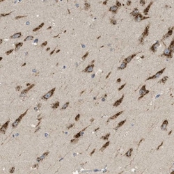 C19orf18 Antibody, Novus Biologicals:Antibodies:Primary Antibodies
