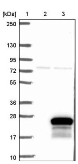 C19orf24 Antibody, Novus Biologicals:Antibodies:Primary Antibodies