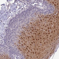 C19orf25 Antibody, Novus Biologicals 0.1mL; Unlabeled:Antibodies, Polyclonal