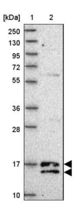 C19orf25 Antibody, Novus Biologicals 0.1mL; Unlabeled:Antibodies, Polyclonal