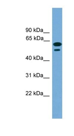 TEX45 Antibody, Novus Biologicals 100&mu;L; Unlabeled:Antibodies, Polyclonal