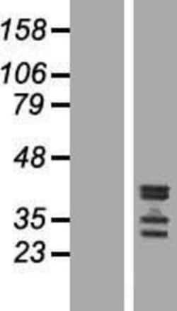 Novus Biologicals&trade;&nbsp;C19orf47 Overexpression Lysate