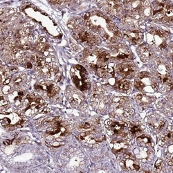C19orf47 Antibody, Novus Biologicals:Antibodies:Primary Antibodies