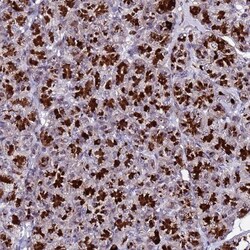 C19orf47 Antibody, Novus Biologicals:Antibodies:Primary Antibodies