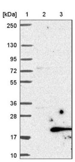 C19orf48 Antibody, Novus Biologicals 0.1mL; Unlabeled:Antibodies, Polyclonal
