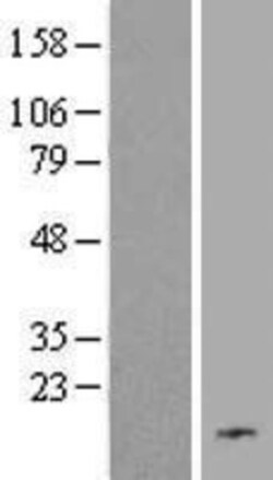 Novus Biologicals&trade;&nbsp;C19orf48 Overexpression Lysate