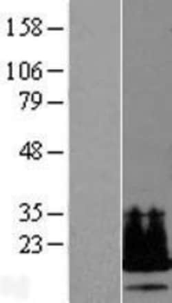 Novus Biologicals&trade;&nbsp;LYDG10 Overexpression Lysate