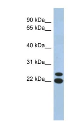 C19orf54 Antibody, Novus Biologicals:Antibodies:Primary Antibodies