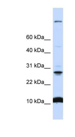 WDR83OS Antibody, Novus Biologicals 100&mu;L; Unlabeled:Antibodies, Polyclonal