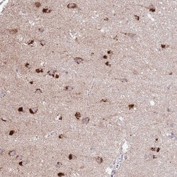 C19orf71 Antibody, Novus Biologicals 0.1mL; Unlabeled:Antibodies, Polyclonal