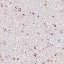 C19orf84 Antibody, Novus Biologicals 0.1mL; Unlabeled:Antibodies, Polyclonal