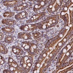 C1D Antibody, Novus Biologicals 0.1mL; Unlabeled:Antibodies, Polyclonal