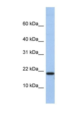 C1D Antibody, Novus Biologicals 100 &mu;L | Buy Online | Novus Biologicals | Fisher Scientific