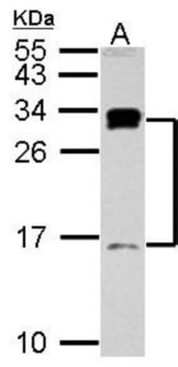 C1D Antibody, Novus Biologicals 0.1mL; Unlabeled:Antibodies, Polyclonal
