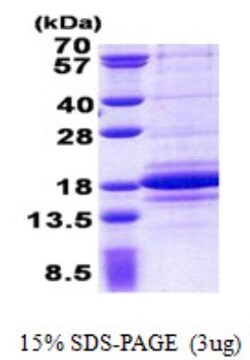 Novus Biologicals&trade;&nbsp;Recombinant Human C1D His Protein
