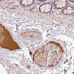 Serpin G1/C1 Inhibitor Antibody, Novus Biologicals:Antibodies:Primary Antibodies