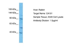 CATSPERE Antibody, Novus Biologicals 100&mu;L; Unlabeled:Antibodies, Polyclonal