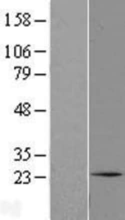 Novus Biologicals™ C1orf105 Overexpression Lysate