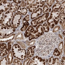 C1orf109 Antibody, Novus Biologicals:Antibodies:Primary Antibodies