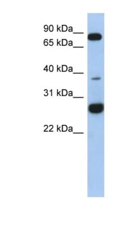 CCDC190 Antibody, Novus Biologicals 100 &mu;L | Buy Online | Novus Biologicals | Fisher Scientific