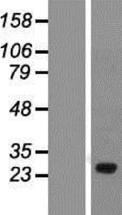 Novus Biologicals&trade;&nbsp;SPATA46 Overexpression Lysate
