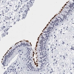 CCDC181 Antibody, Novus Biologicals:Antibodies:Primary Antibodies