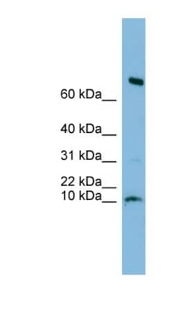 C1orf122 Antibody, Novus Biologicals 100&mu;L; Unlabeled:Antibodies, Polyclonal