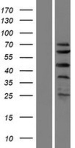 R&D Systems&trade;&nbsp;SPRTN Overexpression Lysate
