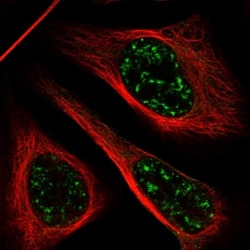 C1orf127 Antibody, Novus Biologicals:Antibodies:Primary Antibodies