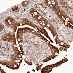 C1orf127 Antibody, Novus Biologicals:Antibodies:Primary Antibodies