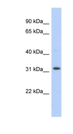 C1orf131 Antibody, Novus Biologicals 100 &mu;L | Buy Online | Novus Biologicals | Fisher Scientific
