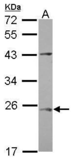 C1orf146 Antibody, Novus Biologicals 0.1mL:Antibodies, Polyclonal