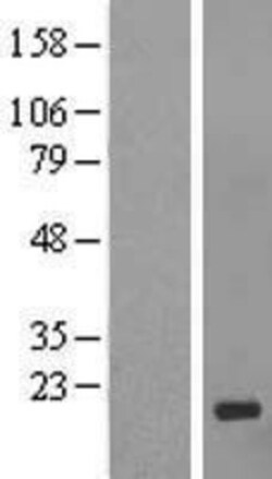 Novus Biologicals&trade;&nbsp;GCSAML Overexpression Lysate
