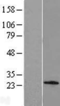 Novus Biologicals™ C1orf158 Overexpression Lysate