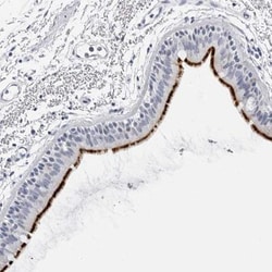 ERICH3 Antibody, Novus Biologicals 25 &mu;L, Unlabeled:Antibodies, Polyclonal