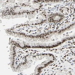 C1orf174 Antibody, Novus Biologicals:Antibodies:Primary Antibodies