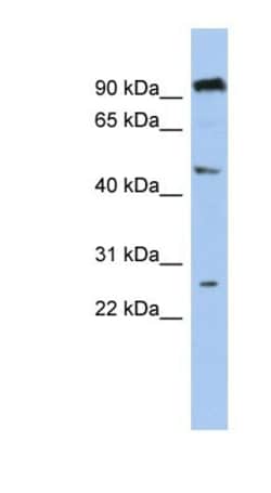 C1orf174 Antibody, Novus Biologicals 100μL; Unlabeled:Antibodies, Polyclonal