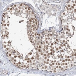 Lymphocyte Expansion Molecule Antibody, Novus Biologicals 0.1mL; Unlabeled:Antibodies,