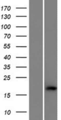Novus Biologicals&trade;&nbsp;C1orf194 Overexpression Lysate