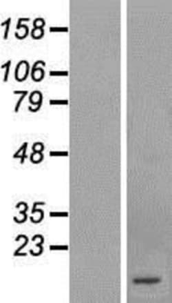 Novus Biologicals&trade;&nbsp;TEMP Overexpression Lysate