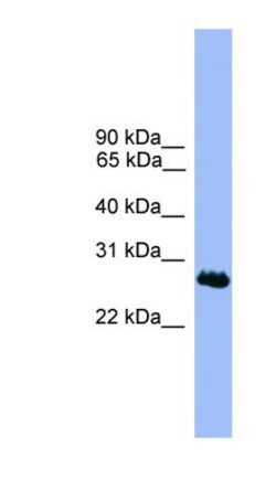 C1orf216 Antibody, Novus Biologicals:Antibodies:Primary Antibodies