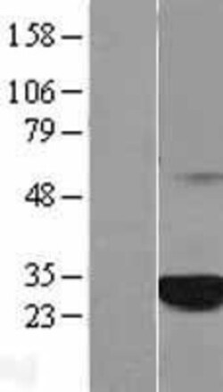 Novus Biologicals&trade;&nbsp;C1orf216 Overexpression Lysate