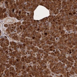 CFAP74 Antibody, Novus Biologicals 0.1mL; Unlabeled:Antibodies, Polyclonal