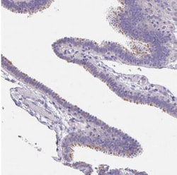 CFAP74 Antibody, Novus Biologicals 0.1mL; Unlabeled:Antibodies, Polyclonal