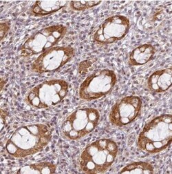 C1orf226 Antibody, Novus Biologicals 25 &mu;L, Unlabeled:Antibodies, Polyclonal